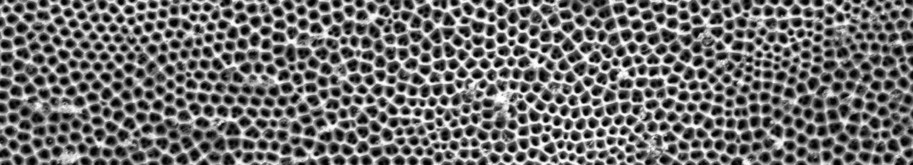Eine Rasterelektronenmikroskopie-Aufnahme von einer Membran mit gleichmäßigen zylindrischen Poren.